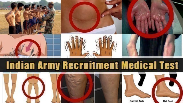 'Indian Army Recruitment Medical Test Video | Hands, Legs, Fingers, Chest in Medical Details | # 2'