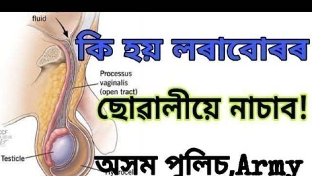 'ছোৱালীয়ে নাচাব এইটো ভিডিঅ\'//INDIAN ARMY,ASSAM POLICE Medical Test Video in Assamese by Jitu Mani'