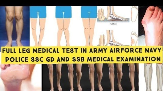 'Leg Medical Test In Army, Airforce, Navy, Police, BSF, CRPF, CISF, IPS, SSC GD And SSB Medical Test'