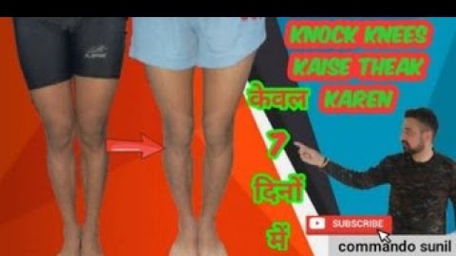 'केवल 7 दिनों में Knock knee कैसे ठीक करें //#knock_knees_best_exercise and tips in hindi //#army'