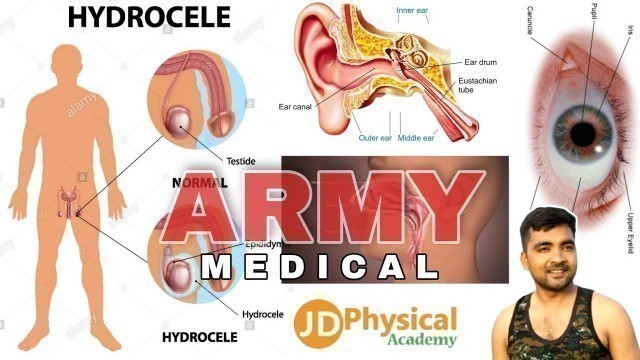 'Indian Army Medical Test in Hindi 2021 Full Video Army Rally Bharti Medical All Force Test - JD Sir'