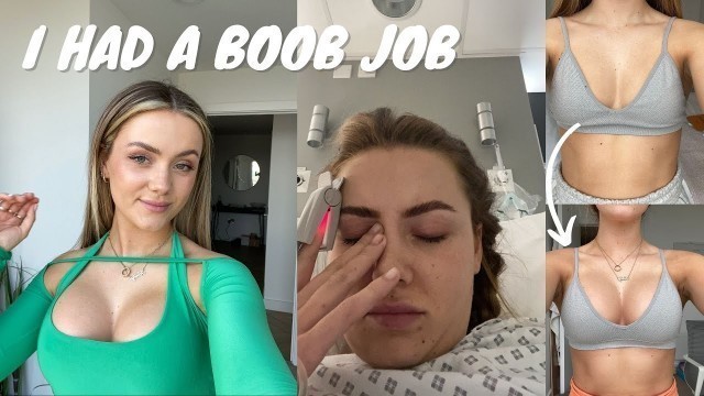 'I HAD A BOOB JOB | Lets chat price, surgery, recovery and what I wish I knew'