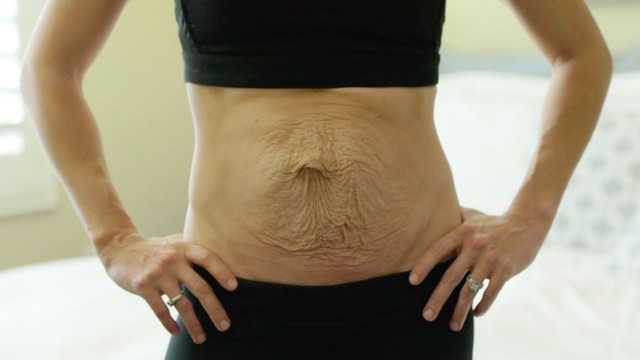 'Bikini Competitor Embraces Stretch Marks After Twins | SHAKE MY BEAUTY'