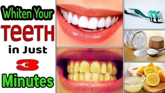 'Whiten Your Teeth Naturally in Just 3 Minutes - Health and Fitness || Life Care'